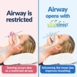 Anti Snurk Tandheelkundige Zorg - Snuring Stopper tegen Snorchen & Snurken - Afbeelding 2