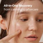 ISNTREE – Onion Newpair Spot Patch Skin-Fit - Afbeelding 3