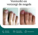 Nail Care Pen - Afbeelding 7