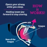 Anti Snurk Apparaat - Afbeelding 2