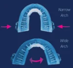 Anti Snurk Apparaat - Afbeelding 4