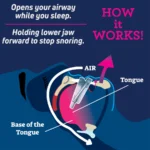 Anti Snurk Apparaat - Afbeelding 5