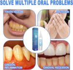 EELHOE Pro - Tandvlees Herstel & Whitening Gel - Afbeelding 7